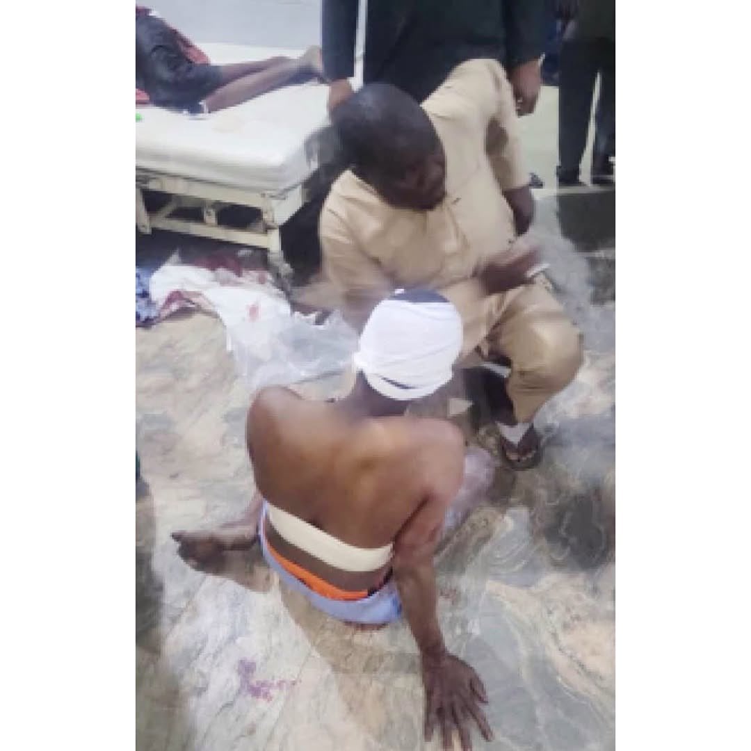 instablog9ja's tweet photo. Maiduguri Explos+ons: 23 Confirmed D+ad as Number of Inj¥red Residents Rises to Over 140

At least 23 people have been confirmed d+ad, with 146 others inj¥red, following a series of explosions that rocked Maiduguri on Monday night.

The blasts struck key locations across the city, including the entrance of University of Maiduguri Teaching Hospital (UMTH), Monday Market, and the Post Office area, sending panic through the once relatively calm city.

According to Surajo Abdullahi of National Emergency Management Agency (NEMA), a total of 169 victims were evacuated to hospitals across Maiduguri.

He disclosed that 108 victims are currently receiving treatment at UMTH, while 20 are at Umaru Shehu Hospital and 17 at Maiduguri Specialist Hospital. Residents described the att+cks as a chilling return to dark days of v#olence the city had long moved past.

One resident, who spoke anonymously, said the explosions have brought back fear and disturbing scenes, signaling a worrying resurgence of insecurity.

The last major incident in the city occurred in 2021, when suspected Boko Haram f+ghters launched mortar att+cks that left at least 10 people d+ad, followed by a s¥icide b@mbingat a mosque in Gambarou market.

In response to the latest tragedy, the Borno State Police Command has deployed its Explosive Ordnance Disposal (EOD) team to assess the իրավիճ, while joint security operatives and emergency responders have taken control of the situation.

The incident comes barely hours after another att+ck on a military location in Ajilari, an outskirt of Maiduguri, raising fresh concerns over a possible escalation of v#olence in the region.