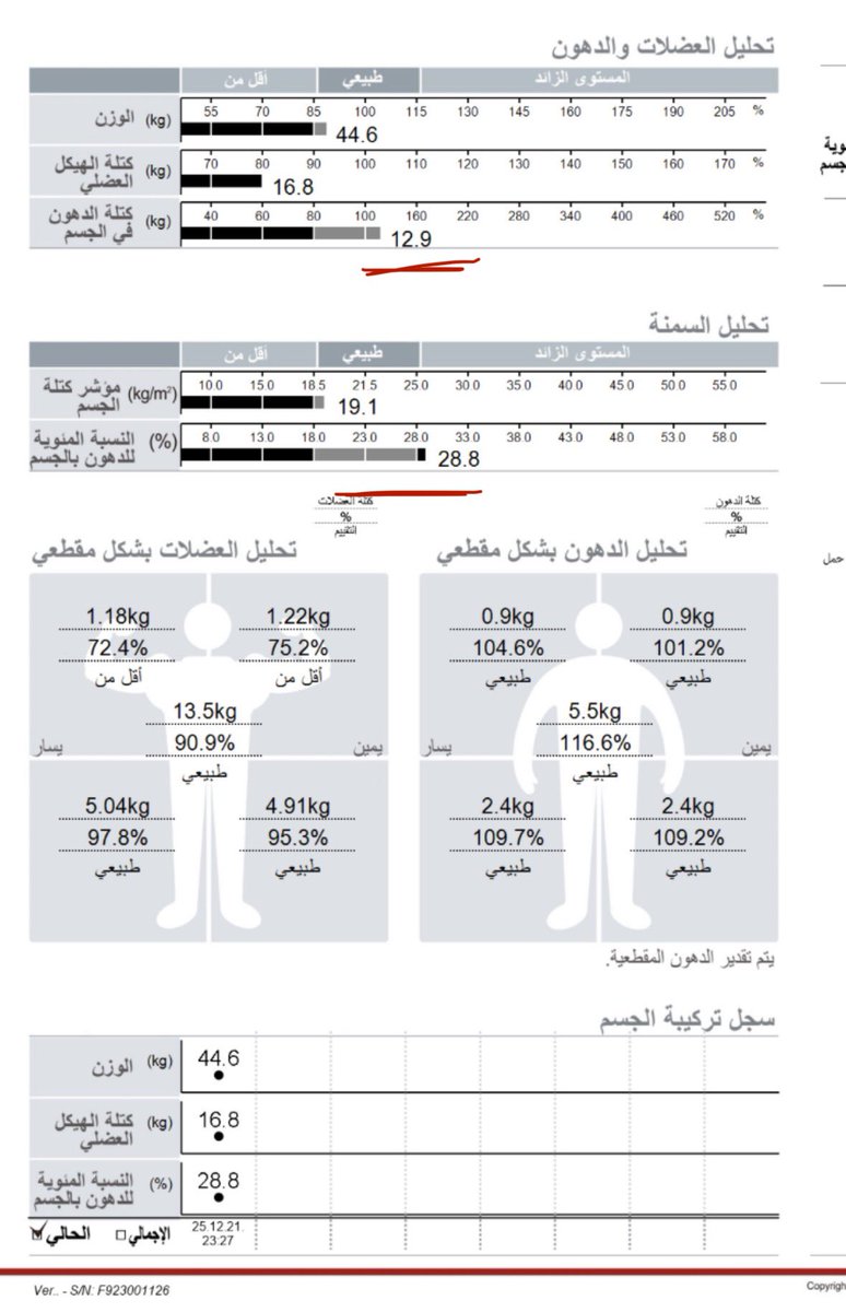 sh56_5's tweet photo. هل دخلت ٢٠٢٦ بخصر فلات ؟ نعمممم 
صح ان وزني نزل كثير بس شعور ان اي لبس مفتوح البطن حلو علي مقدر اوصفه 🥲
صار الان تركيزي على زيادة العضل والمرونه
ولاحظت بعد شهيتي للسكر قلت كثيير صرت اشتهي الفواكه اكثر https://t.co/LEVOhLgWzL