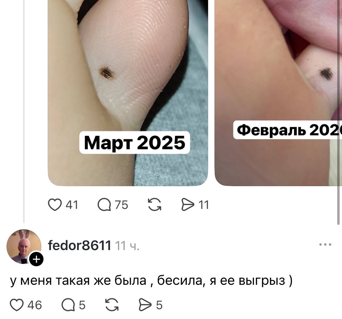 убивалочка tweet media