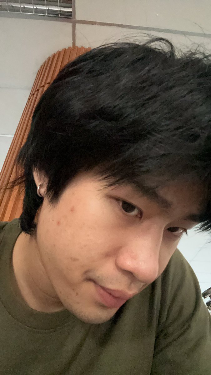 เป็นสิวบ้างตามประสา