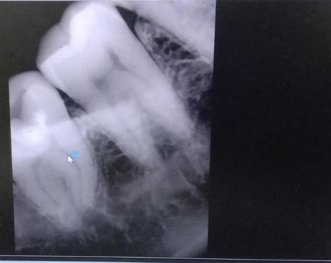 Exodontist tweet media