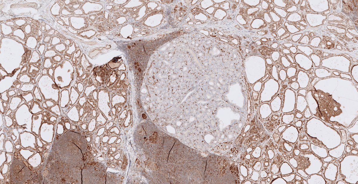 C. Christofer Juhlin tweet media