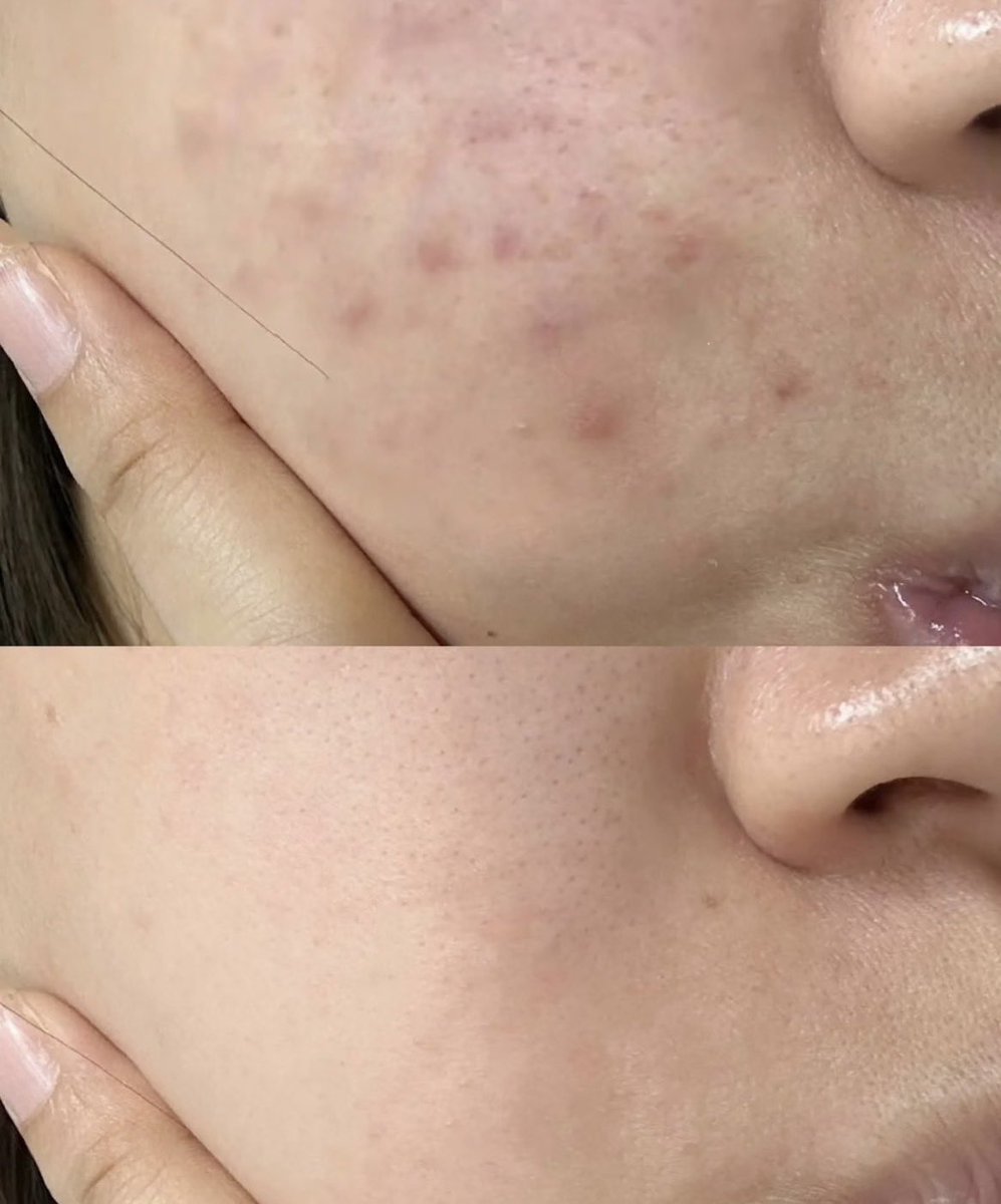 セリナ|韓国コス🇰🇷 tweet media