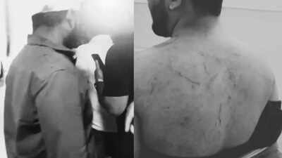 Delhiite_'s tweet photo. 100-150 Strong Mob Attacks 14 Muslims During Ramzan Iftar

📍 Askarwadi, Bopdev Ghat, Pune

A group of 100–150 men, armed with sticks, sharp weapons, whips and stones, arrived on around 100 motorcycles and attacked 14 men from Kondhwa who had gathered near a lakeside for Iftar on Friday evening.
— The assailants questioned their attire and presence before beating them, leaving several injured.
— Saswad Police have filed an FIR against unidentified accused and identified three suspects so far.