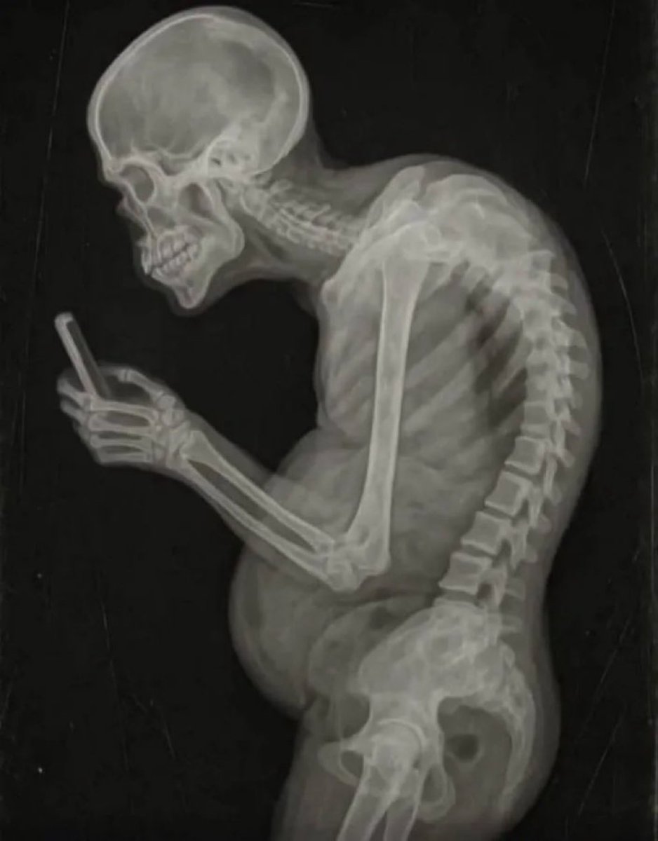 vintermust tweet media