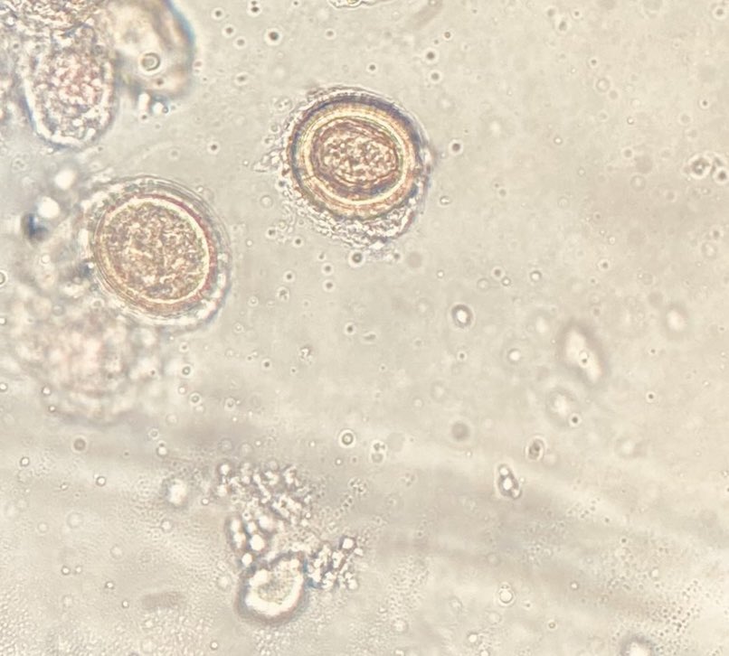 Microbiología Clínica La Paz 🏥 tweet media