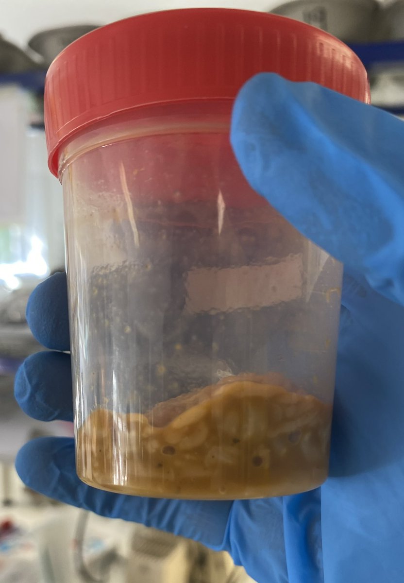 Microbiología Clínica La Paz 🏥 tweet media