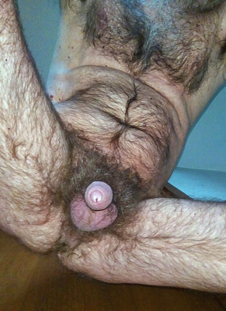 hairy legs tweet media