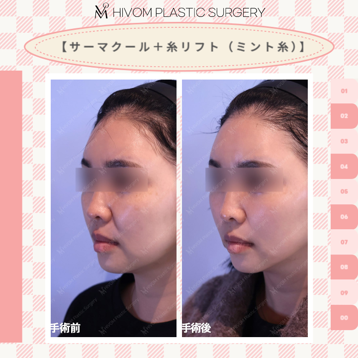 ハイボム美容外科🍑プチ整形🍑 tweet media