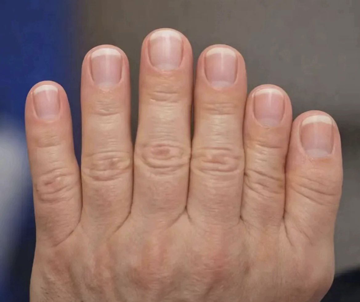 TROY ☎️ tweet media