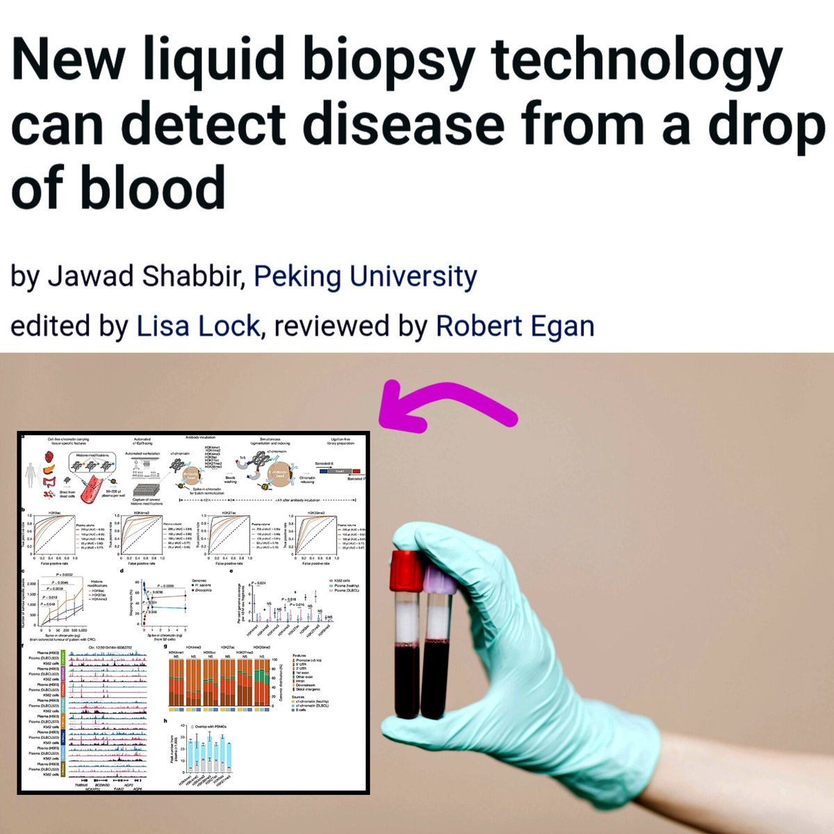 This is insanely GOOD Scientists just turned a simple blood test into a ...