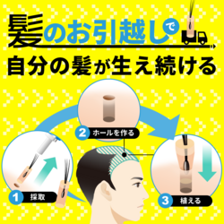 自毛植毛の【親和クリニック】
・メスを使わない
・日帰り手術可能
・高密度
・高生着率
・痛みが少ない
・大量植毛可能
・自然な仕上がり
t.afi-b.com/visit.php?a=y1…