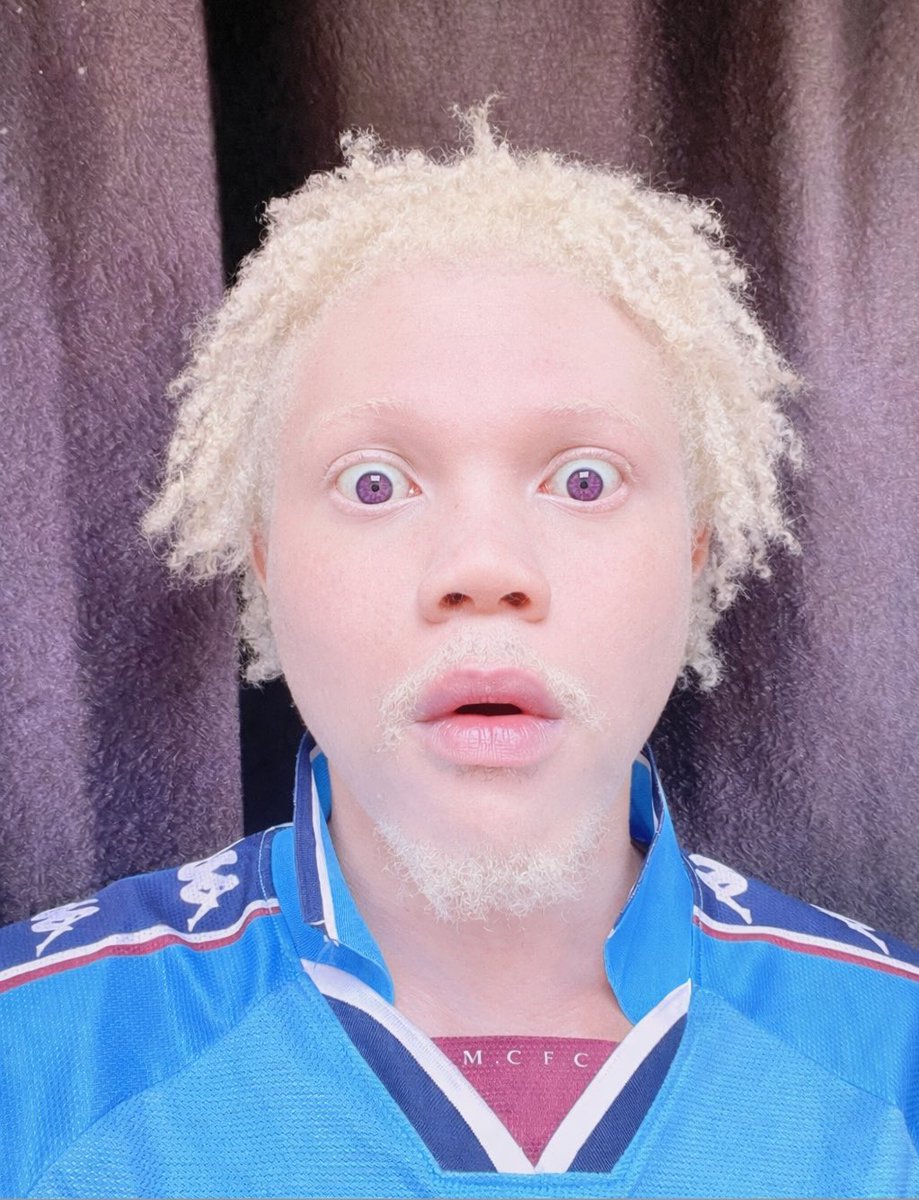 𝘼𝙡𝙞𝙚𝙣𝙗𝙤𝙞🪼🇳🇬 tweet media