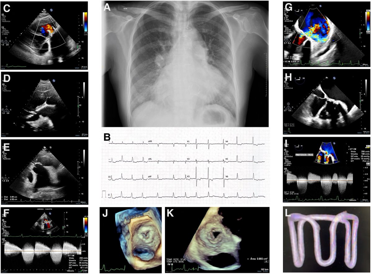 European Society of Cardiology Journals tweet media