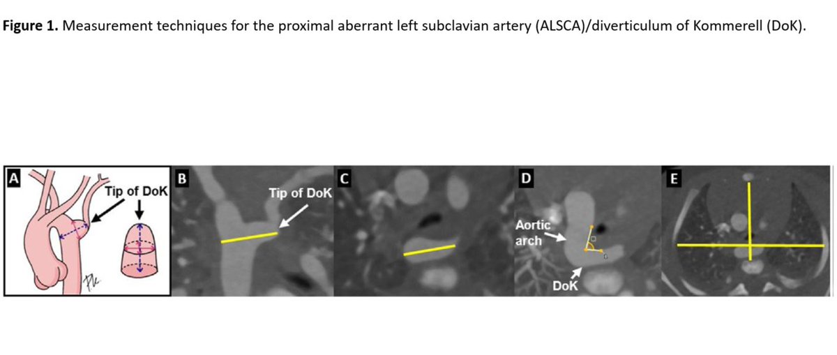 Journal of Cardiovascular CT tweet media