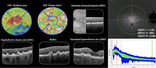 IOVS Journal tweet media