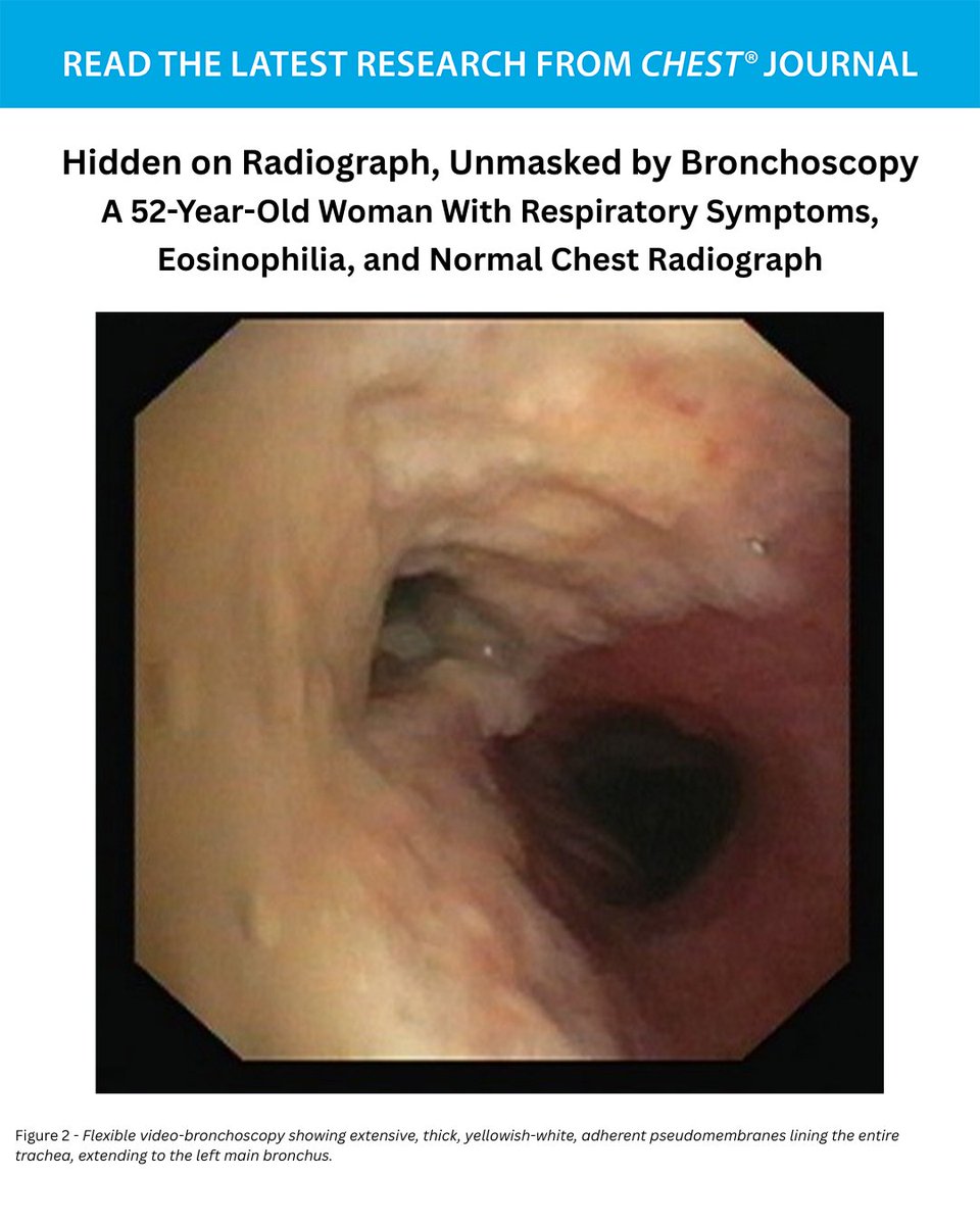 CHEST® Journal tweet media