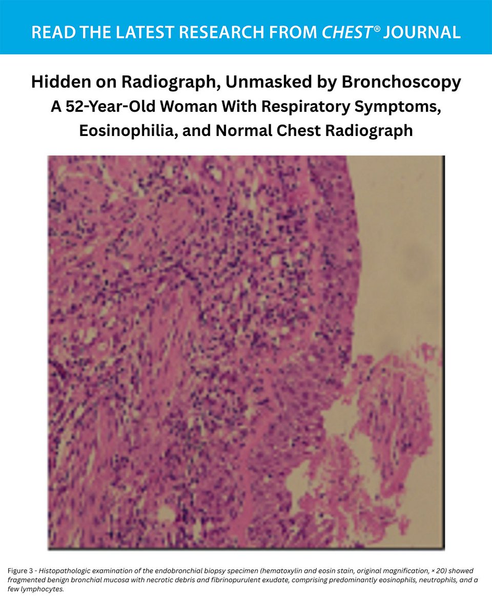 CHEST® Journal tweet media