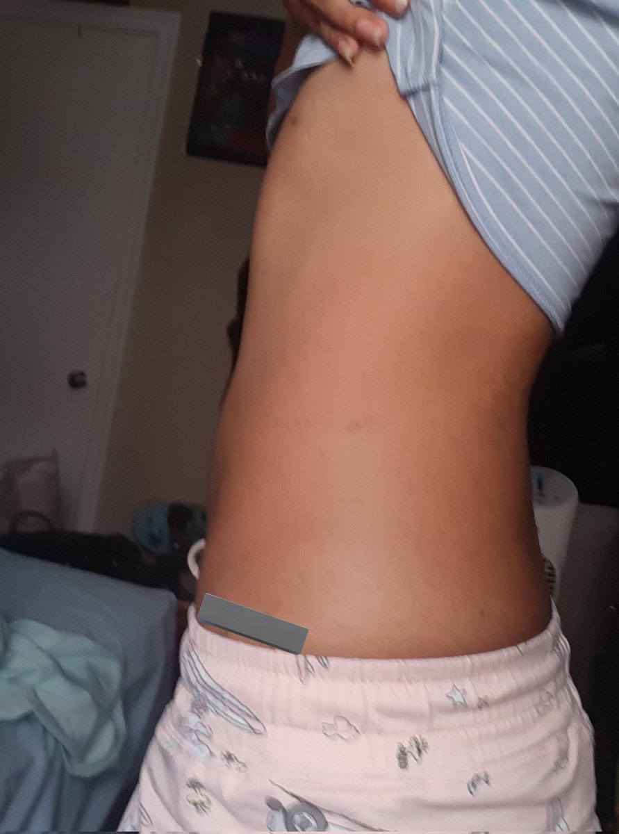bl0od7y's tweet photo. Bc cuz ive returned from a long needed break #skinni https://t.co/xlNArldyfT