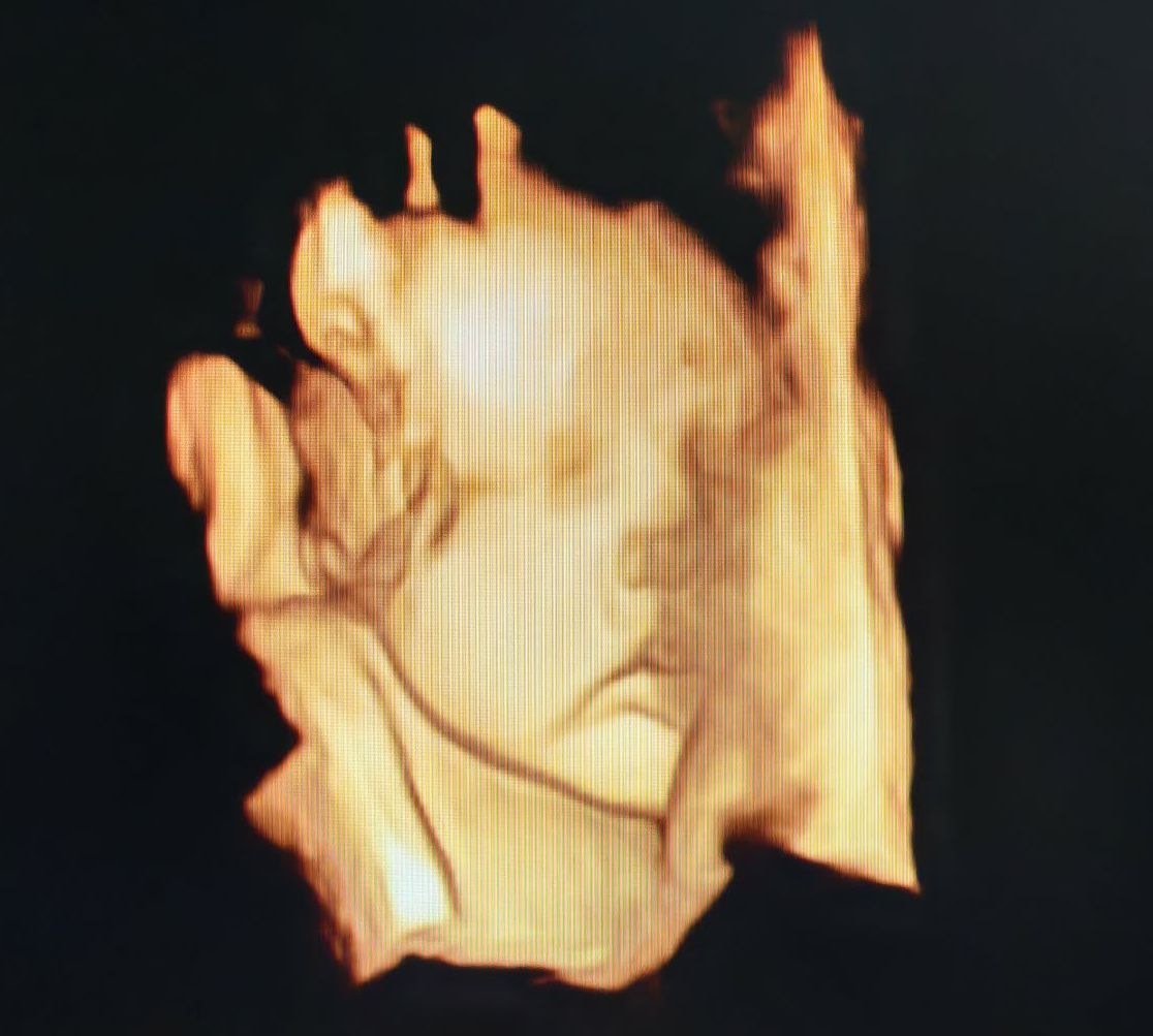 LEROY Nicolas tweet media