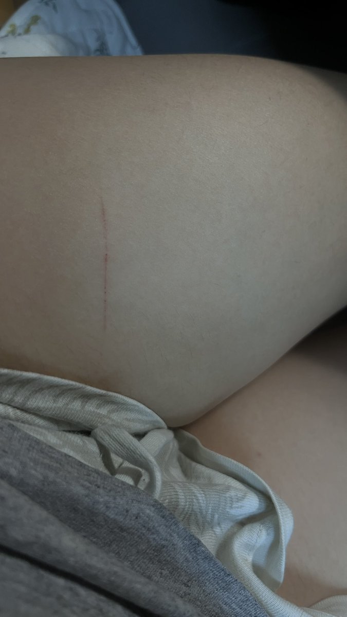 起司蛋餅 tweet media