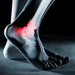 اذا عملت أشعة سينية أو رنين مغناطيسي  للقدم و الكاحل وكانت النتيجة طبيعية 

و مع ذلك ،هذي النتيجة الطبيعية لا تنفي دائمًا وجود مشكلة ، كثير من الإصابات تكون وظيفية أو في الأنسجة الرخوة ولا تظهر بوضوح في الأشعة التقليدية و هذا يأتي دور الطبيب و الفحص الإكلينيكي