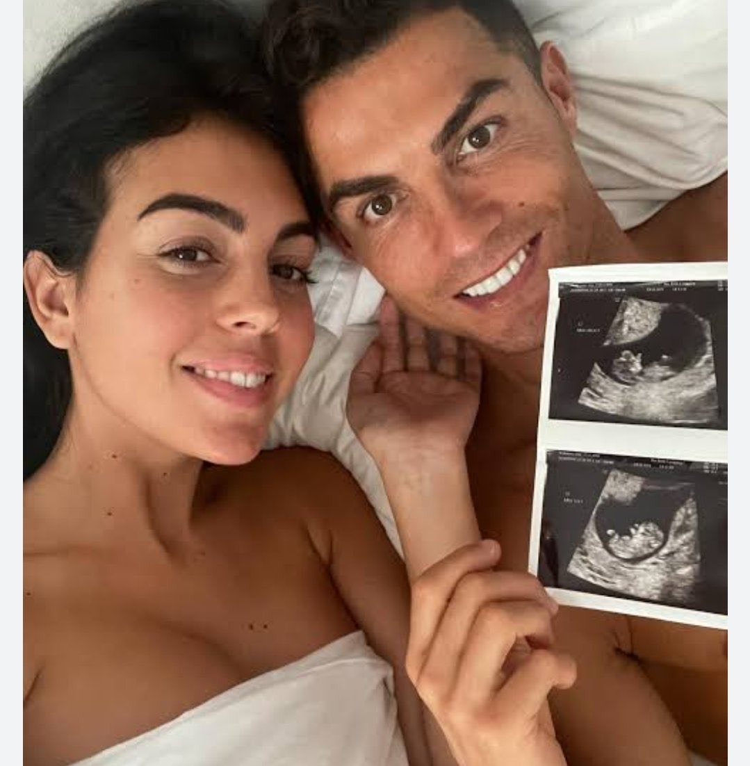 Yven 🧠 tweet media