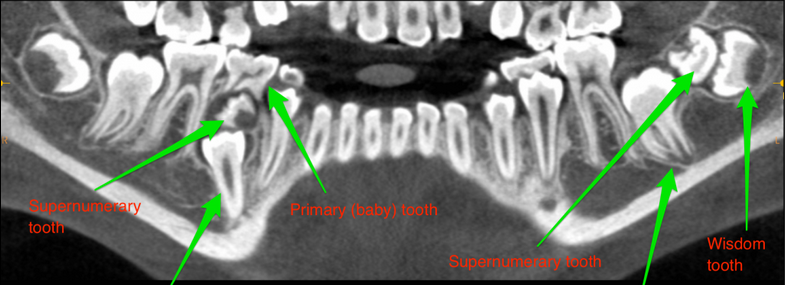 Anesthesia Experts tweet media