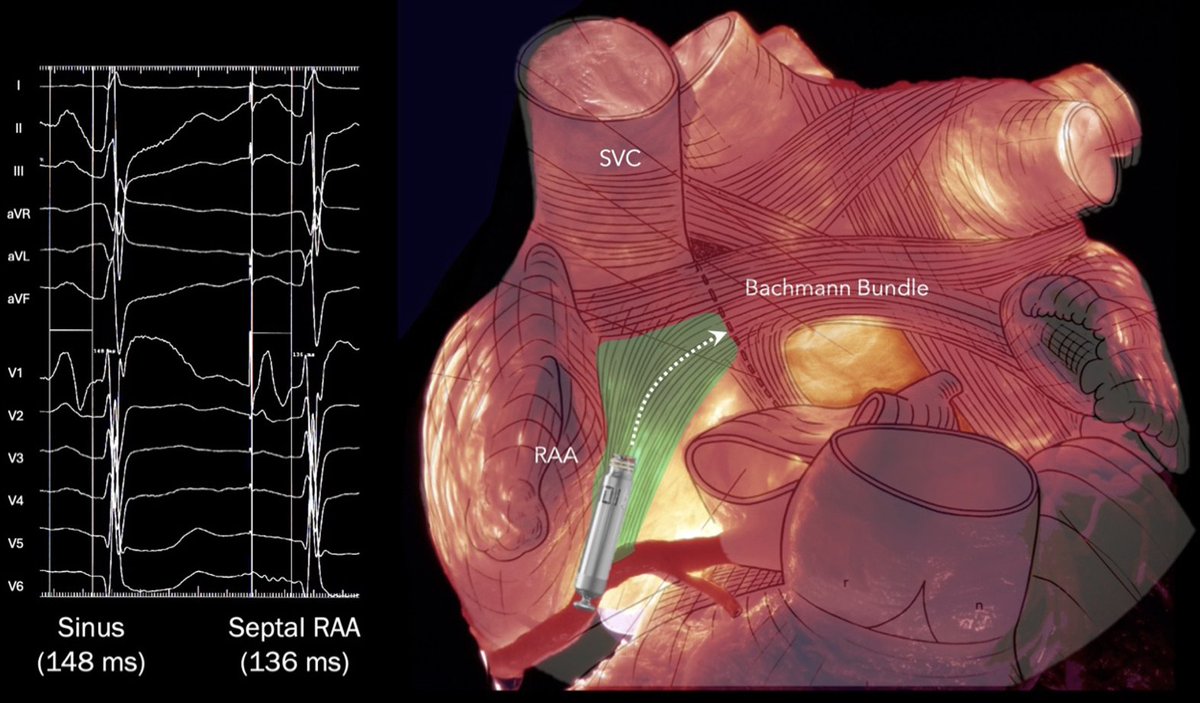 Roderick Tung tweet media
