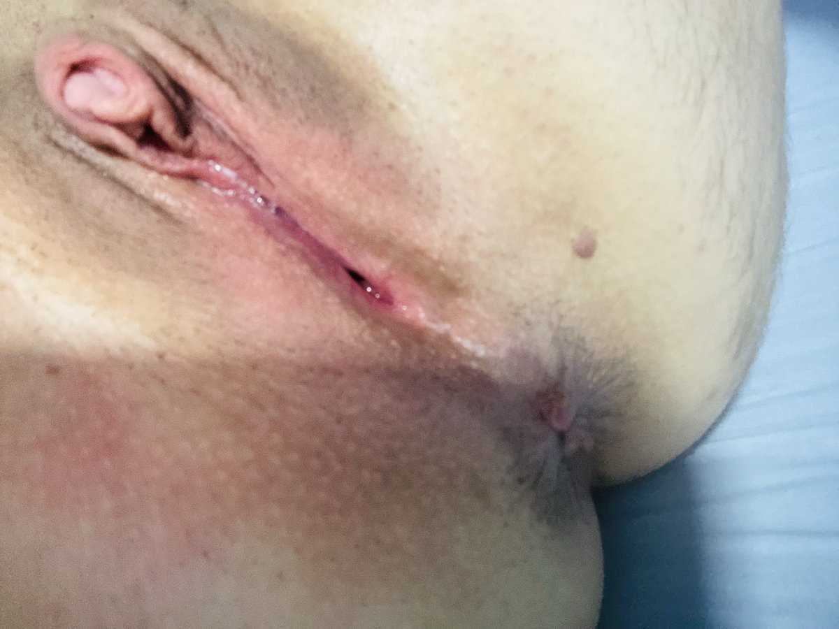 Nih 🏳️‍⚧️ homem trans tweet media