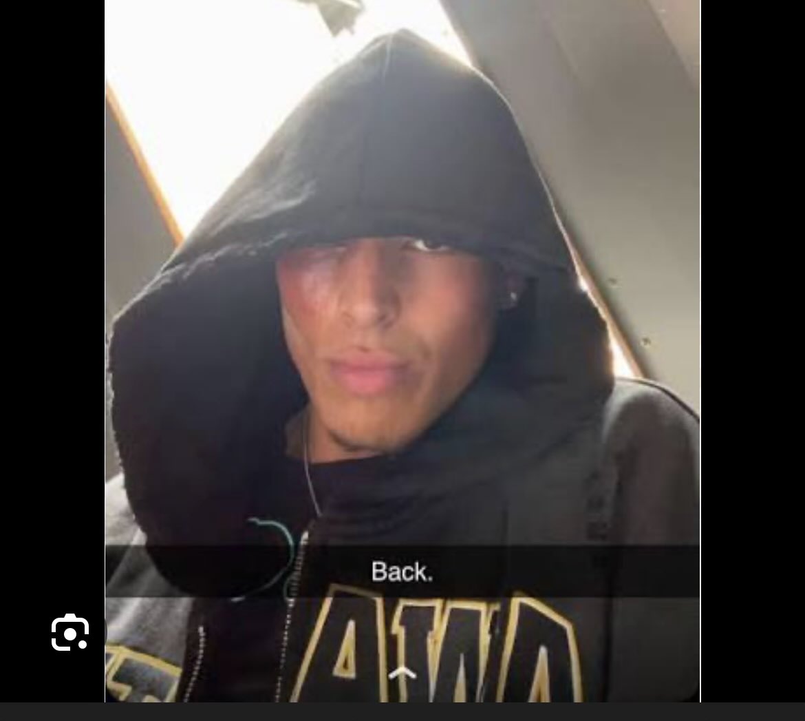 creyzy321's tweet photo. @nofanboymma @clippedszn He has had a full black eye btw https://t.co/5UP411UWOe