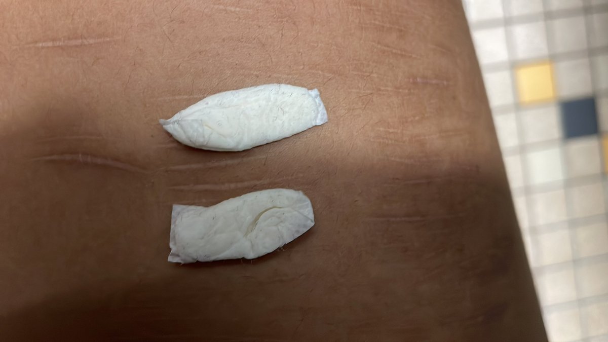 🍥tamaki of shedtwt🧁 tweet media