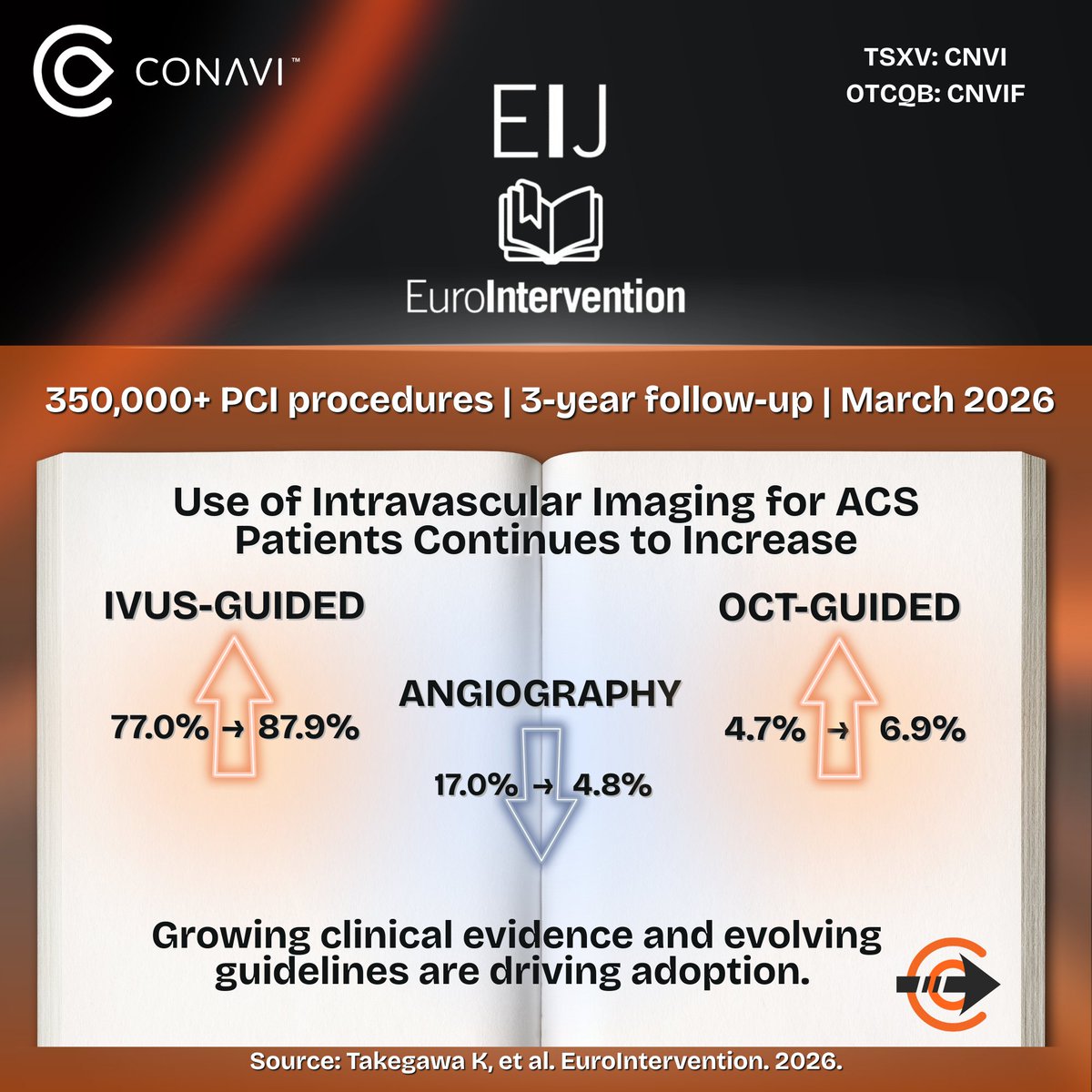 ConaviMed's tweet photo. $CNVI.V $CNVIF 

A @EuroInterventio analysis of 350,000+ coronary procedures in Japan’s National Database, shows how imaging-guided PCI is:

➡️ Delivering significantly better outcomes for ACS patients 
➡️ Driving a fundamental shift in how interventions are performed
➡️ Demonstrating how #IVUS & #OCT reveals what the other cannot

Providing physicians with the ability to leverage strengths of both modalities during the same procedure is what #ConaviMedical feels is an important step forward in #InterventionalCardiology. 🫀

Details 🔗 https://t.co/xvHhkiVw6E