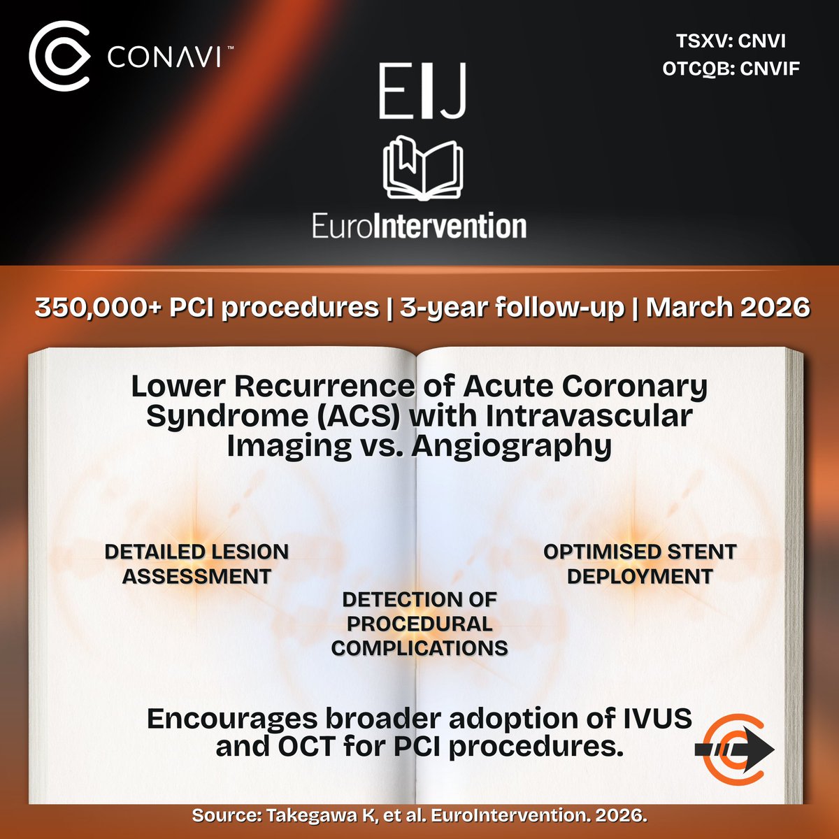 ConaviMed's tweet photo. $CNVI.V $CNVIF 

A @EuroInterventio analysis of 350,000+ coronary procedures in Japan’s National Database, shows how imaging-guided PCI is:

➡️ Delivering significantly better outcomes for ACS patients 
➡️ Driving a fundamental shift in how interventions are performed
➡️ Demonstrating how #IVUS & #OCT reveals what the other cannot

Providing physicians with the ability to leverage strengths of both modalities during the same procedure is what #ConaviMedical feels is an important step forward in #InterventionalCardiology. 🫀

Details 🔗 https://t.co/xvHhkiVw6E