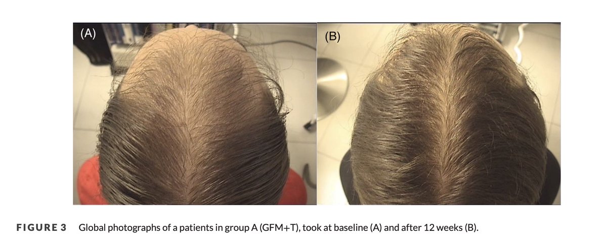 Dalton (Analyze & Optimize) tweet media
