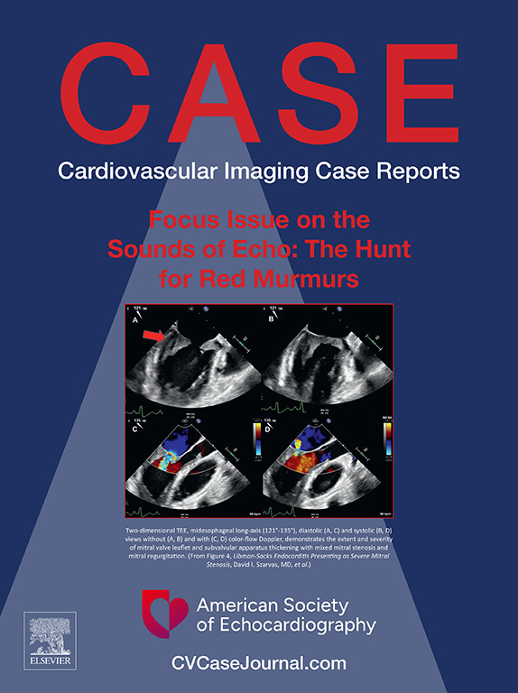 American Society of Echocardiography tweet media