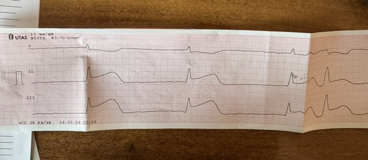 Ігор Васильович MD🫀 tweet media