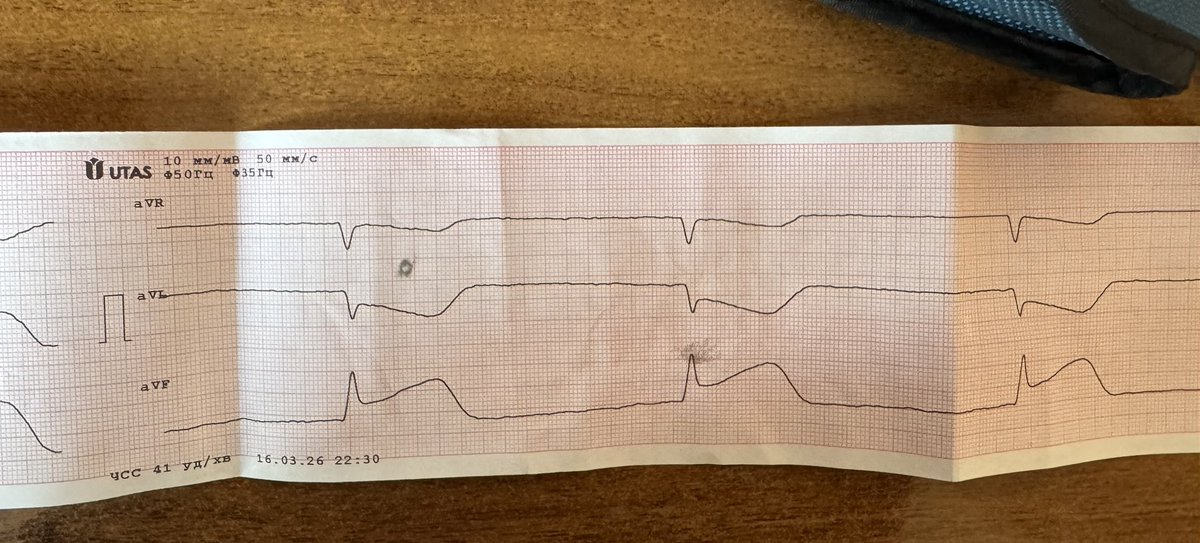 Ігор Васильович MD🫀 tweet media
