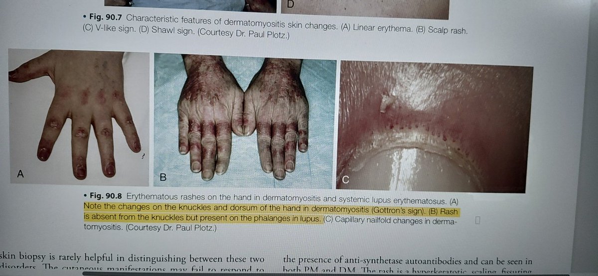 Shreya Bhat tweet media