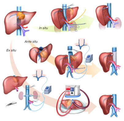 Annals of Surgery tweet media