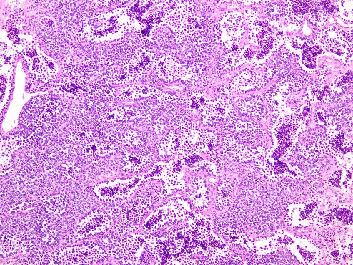 Charlie Herndon tweet media