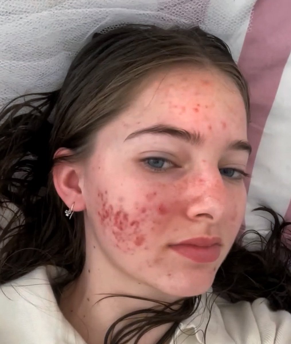 One-piece tweet media