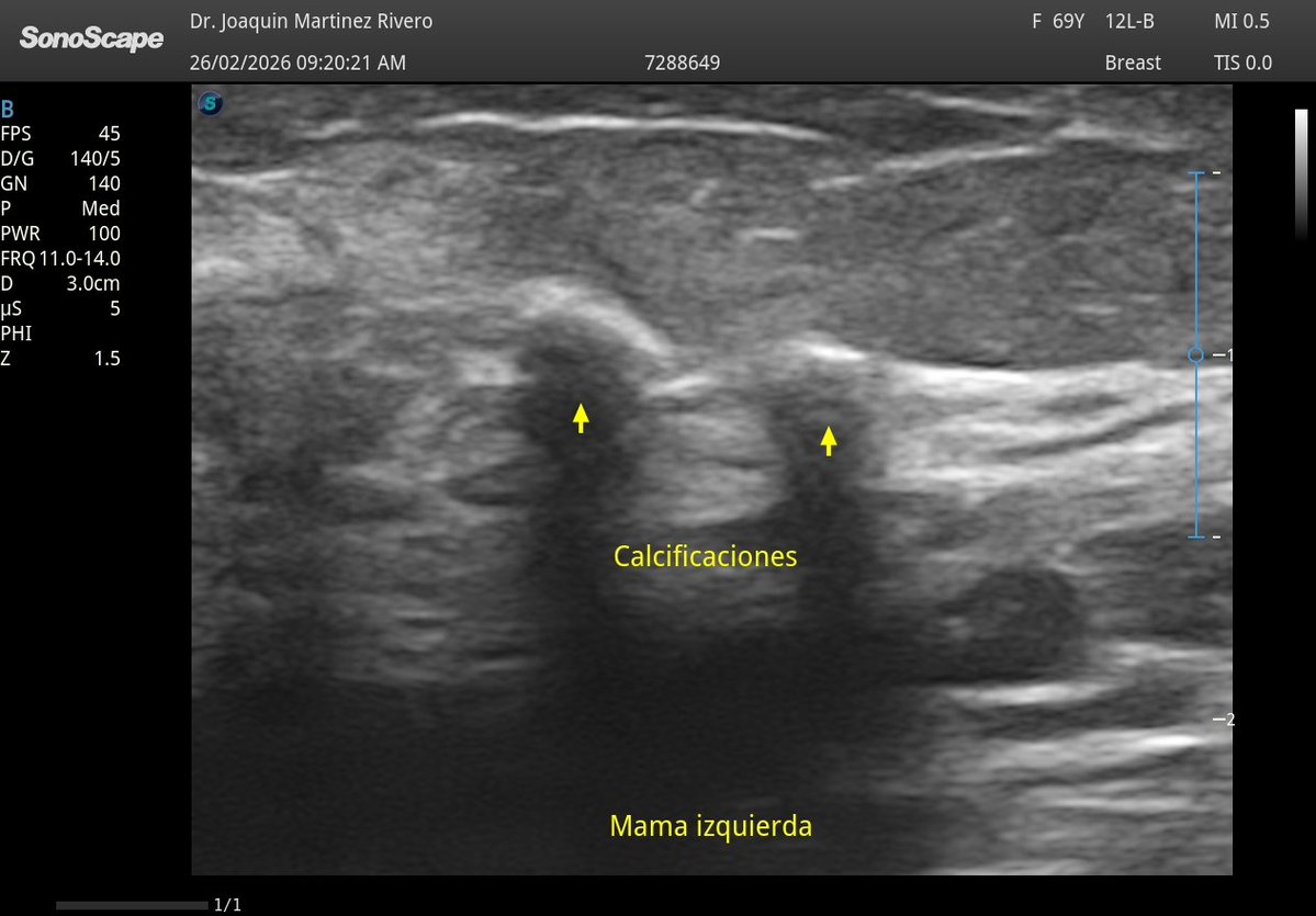 Joaquín Martínez tweet media