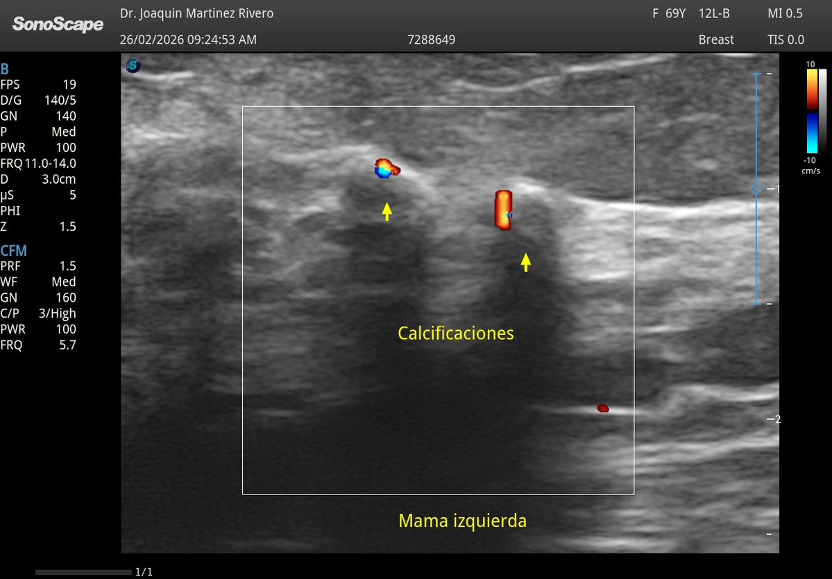 Joaquín Martínez tweet media