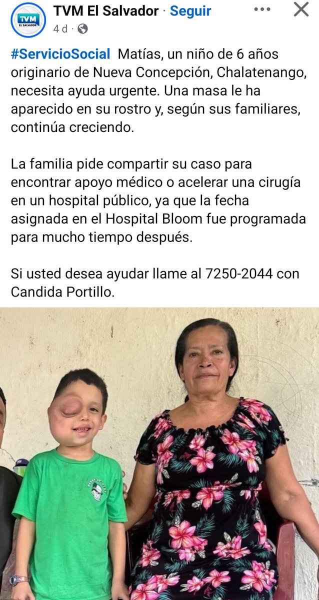 Señor Ministro de Salud <a href="/FranAlabi/">Francisco Alabi 🇸🇻</a>, por favor ayuden a acelerar la cirugía de este niño. Es muy duro ver a una criatura vivir así, cuando existe la posibilidad de gestionar su caso con mayor rapidez. Cc <a href="/SaludSV/">Ministerio de Salud</a> <a href="/nayibbukele/">Nayib Bukele</a>