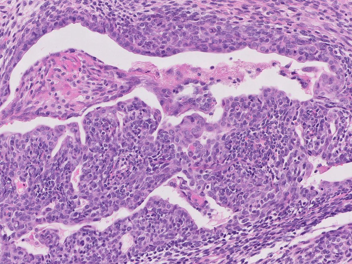 Charlie Herndon tweet media