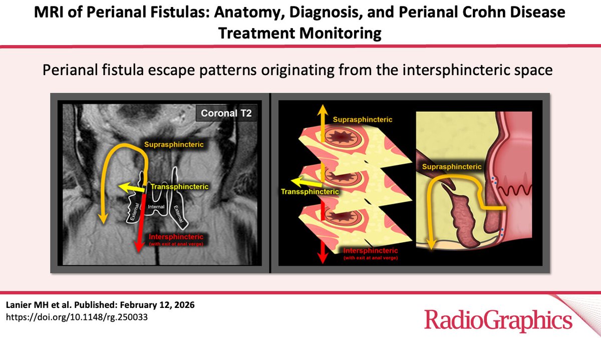 RadioGraphics tweet media
