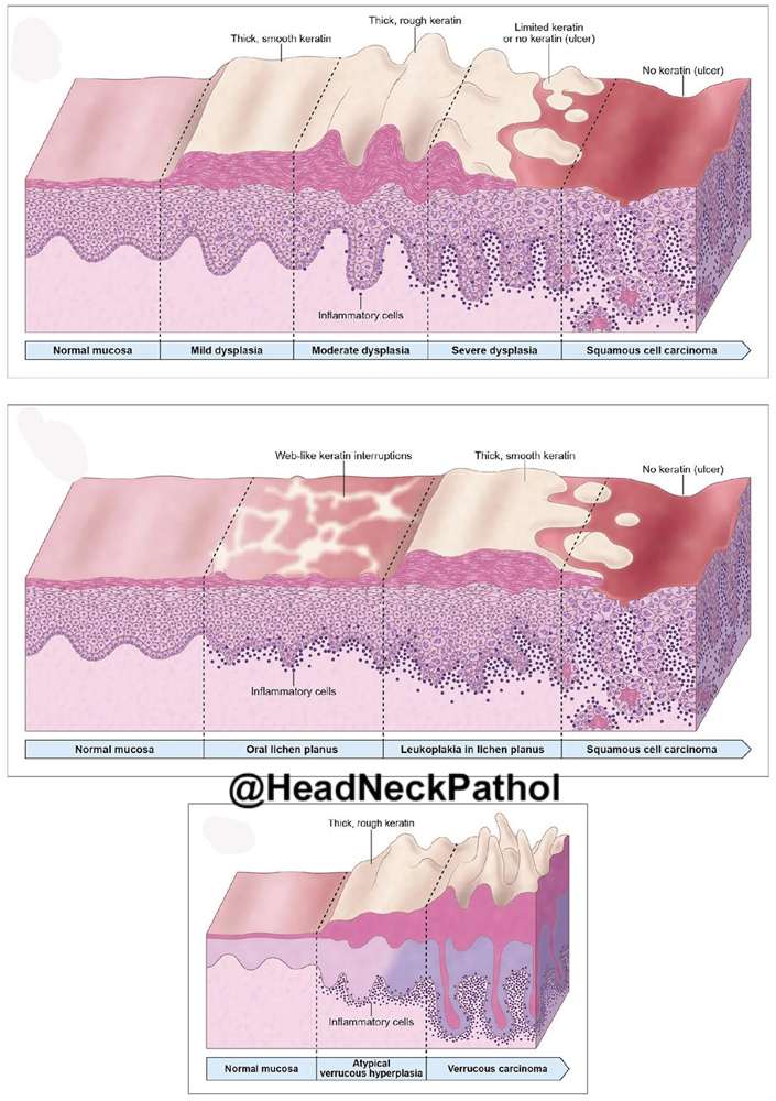 Head Neck Pathol tweet media