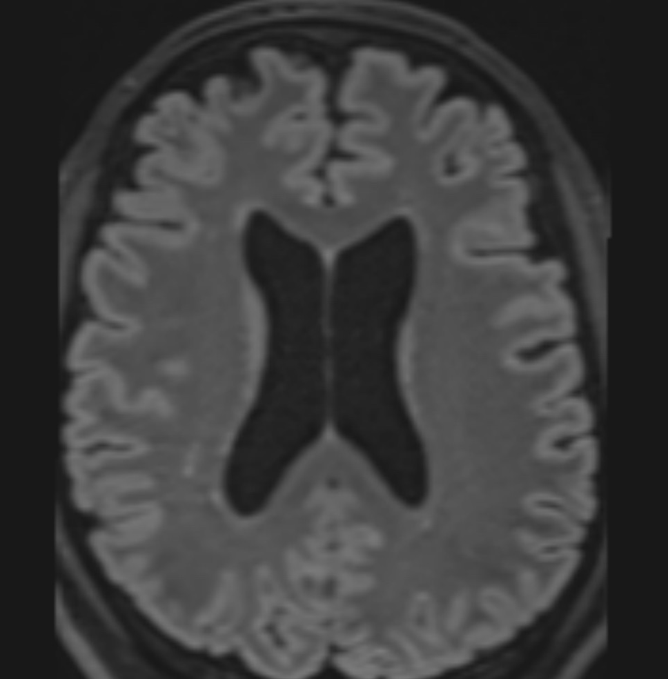 Andrew Micieli tweet media