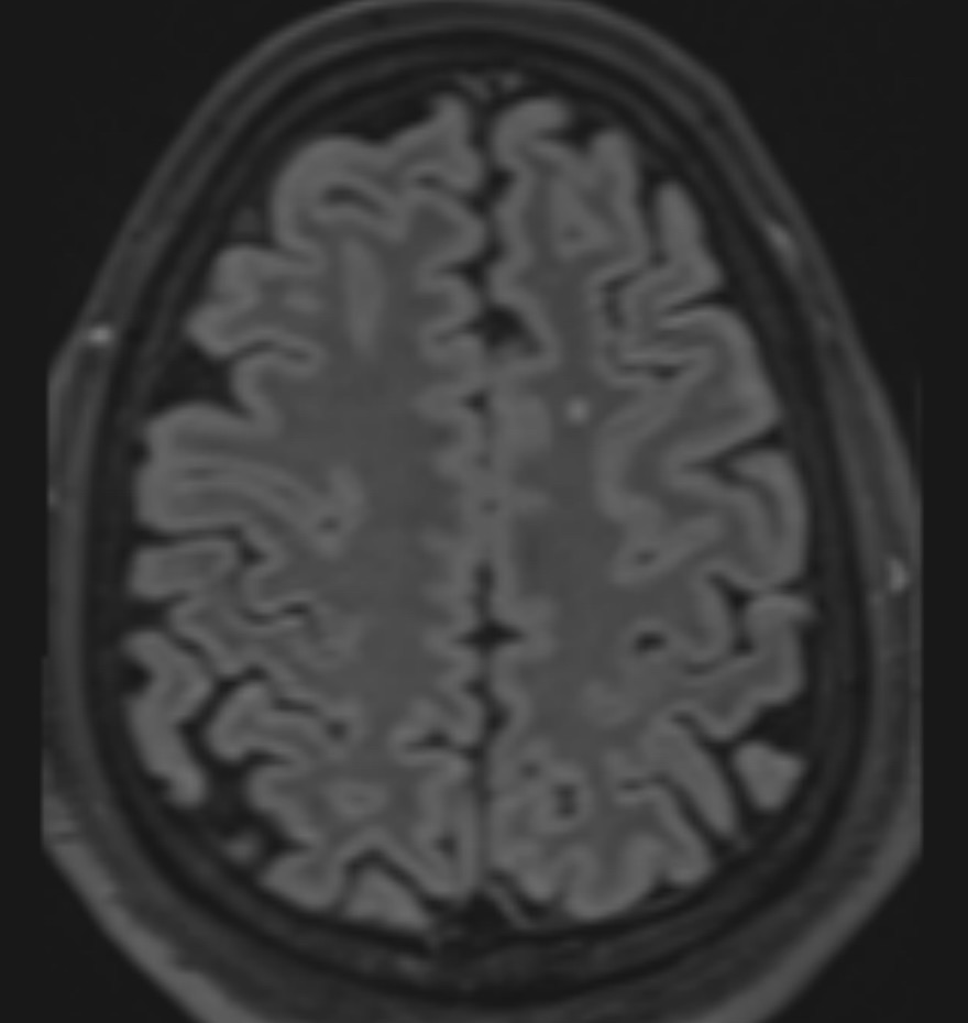 Andrew Micieli tweet media